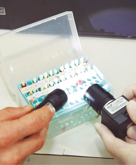 Análise de amostras de dentes em laboratório: sistema aprimora a captura e o processamento digital das imagens
